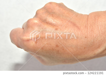 老人的右手：斑點和皺紋 124221191
