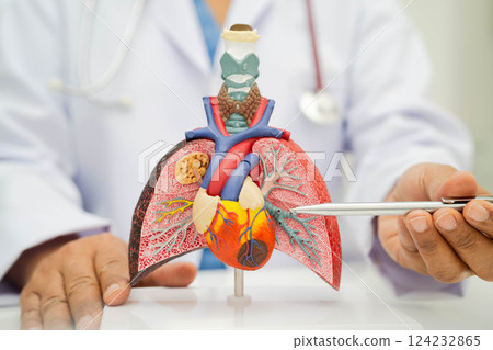 Pneumonia, lung cancer, Asian doctor holding human anatomy model for study diagnosis and treatment in hospital. 124232865