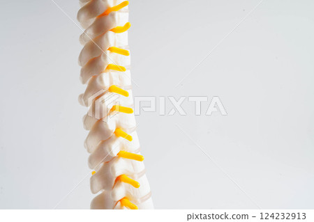 Spinal nerve and bone, Lumbar spine displaced herniated disc fragment, Model for treatment medical in the orthopedic department. 124232913
