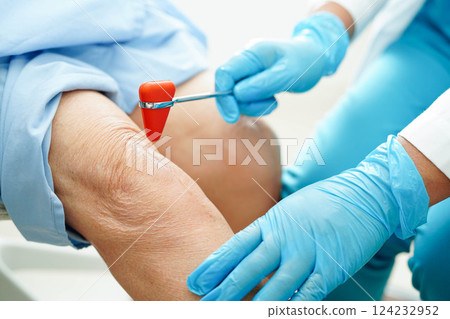 Asian doctor knock on knee reflex nerve for check and treatment senior patient in hospital. 124232952