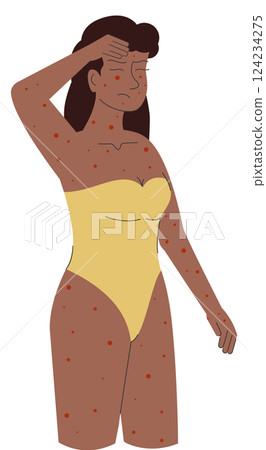Woman suffering from seasonal virus illustration. Monkeypox virus concept. Pandemic vector illustration Woman suffering from seasonal virus illustration. Monkeypox virus concept. Pandemic vector illustration 124234275