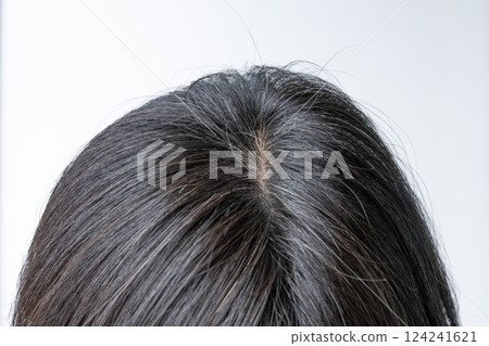 Close-up of white hair on top of head Close-up of white hair on top of head 124241621