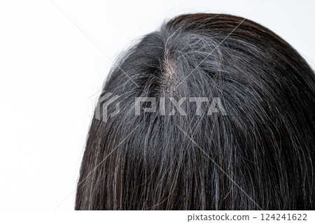頭頂白髮特寫 124241622