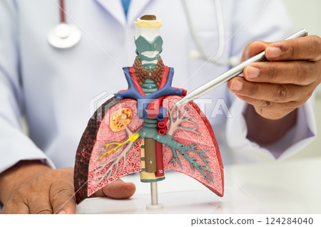 Pneumonia, lung cancer, Asian doctor holding human anatomy model for study diagnosis and treatment in hospital. 124284040