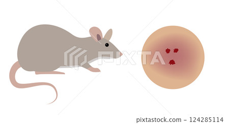Rat Biting Human Skin Causing Bleeding Wound and Infection Rat Biting Human Skin Causing Bleeding Wound and Infection 124285114