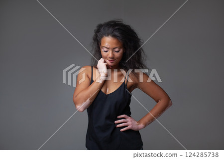 Sensuous female fashion model with vitiligo in Sensuous female fashion model with vitiligo in 124285738