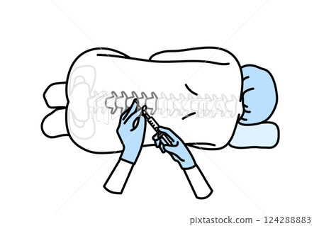 epidural anesthesia epidural anesthesia 124288883