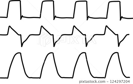 Ventilator graphic waveform material illustration 124297204