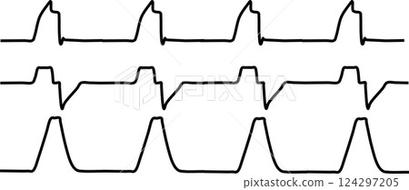 Ventilator graphic waveform material illustration Ventilator graphic waveform material illustration 124297205