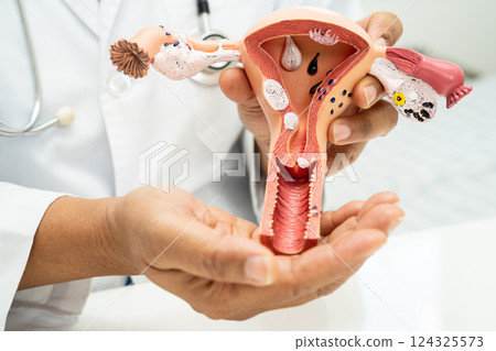 Uterus, doctor with anatomy model for study diagnosis and treatment in hospital. 124325573