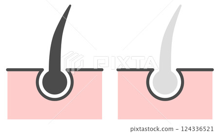 Illustration of hair turning gray due to aging and stress Illustration of hair turning gray due to aging and stress 124336521