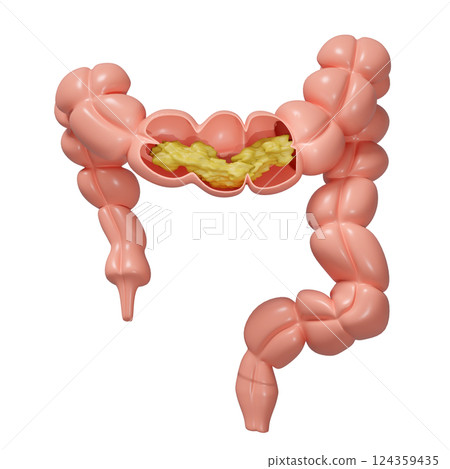 3d human colon cross section with waste in the intestine isolated. check colon health, constipation concept, 3d illustration render 124359435