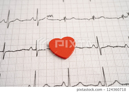Electrocardiogram ECG heart wave, heart attack, cardiogram report. 124360718