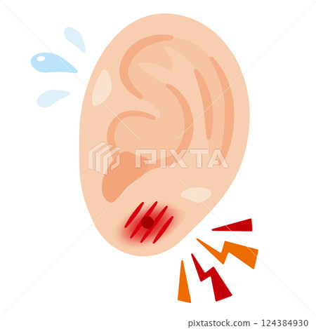 穿孔導致耳朵發炎的圖示 124384930