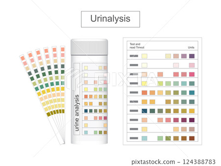A urinalysis is a simple test that checks urine. 124388783