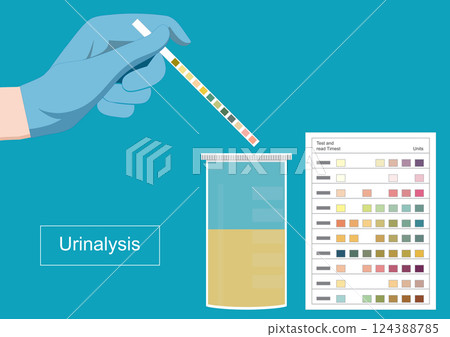 A urinalysis is a test that look at the appearance of pee. A urinalysis is a test that look at the appearance of pee. 124388785