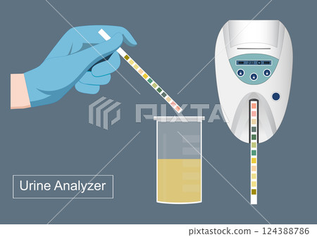 A urine analyser is a device used in the clinical 124388786