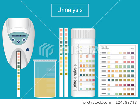 Urine Analysis and urine analyser is a test of urine to check for a urinary tract infection. Urine Analysis and urine analyser is a test of urine to check for a urinary tract infection. 124388788