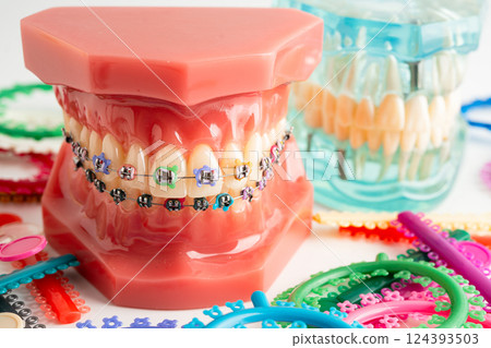 Orthodontic ligatures rings and ties, elastic rubber bands on orthodontic braces, model for dentist studying about dentistry. 124393503