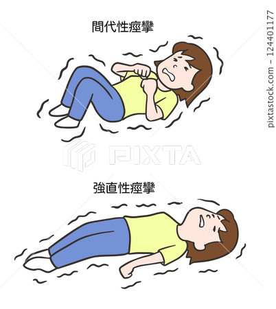 女性陣攣性癲癇與強直性癲癇 女性陣攣性癲癇與強直性癲癇 124401177