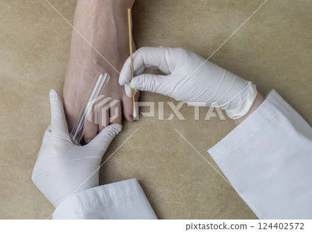 Dermatologist using a cotton swab and test tube to take a swab sample from a patient's leg. Diagnosis of fungal infection, scraping fungal  and microbiological examination 124402572