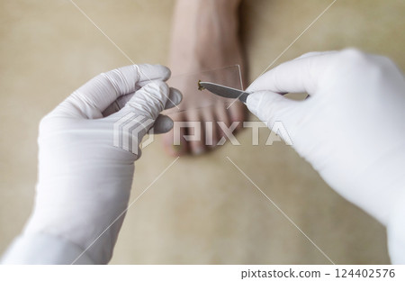 A podiatrist takes a scraping from a nail to examine for a fungal infection. Microbiological examination, taking a swab for the treatment of nail disease A podiatrist takes a scraping from a nail to examine for a fungal infection. Microbiological examination, taking a swab for the treatment of nail disease 124402576