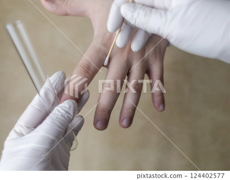 Dermatologist collects skin swab sample from patient's arm using cotton swab and test tube. Microbiological analysis. Diagnosis of skin diseases, fungi and infections Dermatologist collects skin swab sample from patient's arm using cotton swab and test tube. Microbiological analysis. Diagnosis of skin diseases, fungi and infections 124402577