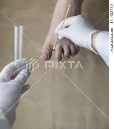 Dermatologist using a cotton swab and test tube to take a swab sample from a patient's leg. Diagnosis of fungal infection, scraping fungal and microbiological examination Dermatologist using a cotton swab and test tube to take a swab sample from a patient's leg. Diagnosis of fungal infection, scraping fungal and microbiological examination 124402580