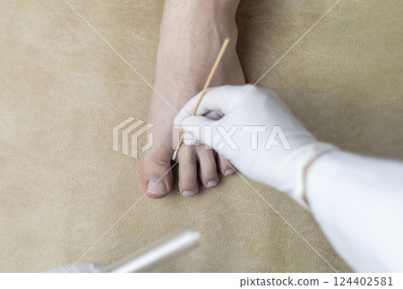 Dermatologist using a cotton swab and test tube to take a swab sample from a patient's leg. Diagnosis of fungal infection, scraping fungal  and microbiological examination 124402581