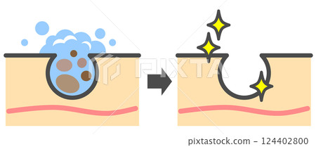 清潔肌膚、清除毛孔中的黑頭、獲得美麗肌膚的插圖 124402800