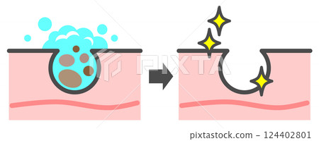 清潔肌膚、清除毛孔中的黑頭、獲得美麗肌膚的插圖 124402801