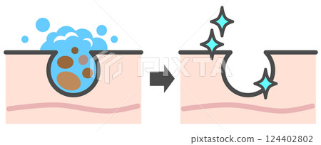 Illustration of cleansing the skin, washing away blackheads from pores, and getting beautiful skin 124402802