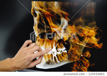 The dentist shows the patient his x-ray of the jaw. Panoramic shot of teeth on the screen at the dentist 124416863