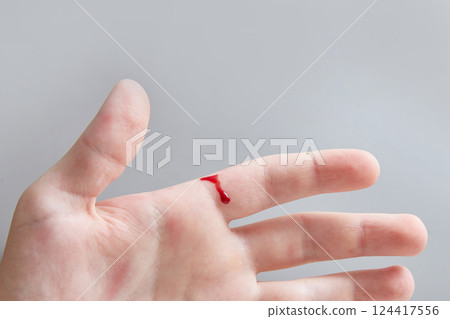 Close-up of a hand with a bloody cut. Close-up of a hand with a bloody cut. 124417556