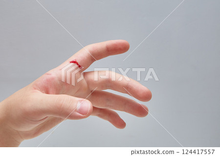 Blood on the hand. A knife cut. close-up. Copy space, blue background. 124417557