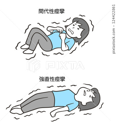 陣攣性和強直性驚厥,女性 2 陣攣性和強直性驚厥,女性 2 124422861