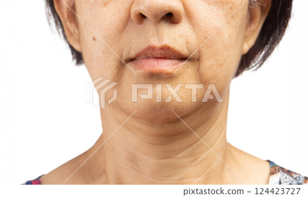 Senior asian woman worry about eye bags and dark spot. 124423727