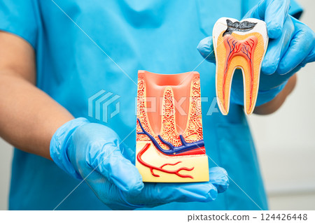 Asian dentist holding dental implant, artificial tooth roots into jaw, root canal of dental treatment, gum disease, teeth model for dentist. 124426448
