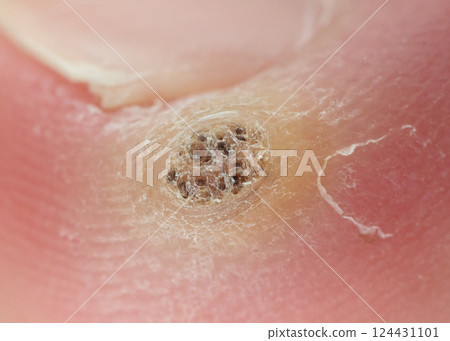 Image photo 124431101