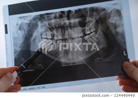 Doctor examines a dental X-ray to determine the best treatment approach for the patient. 124440449