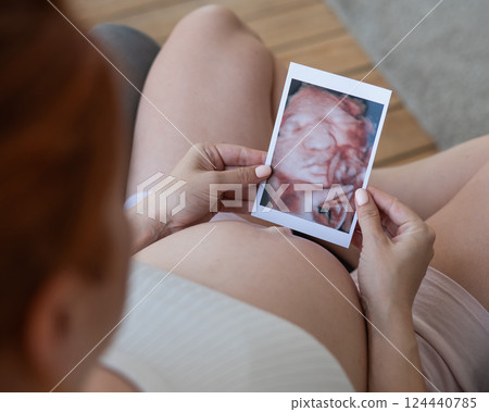 Pregnant woman holding 3d photo of baby with ultrasound. Pregnant woman holding 3d photo of baby with ultrasound. 124440785