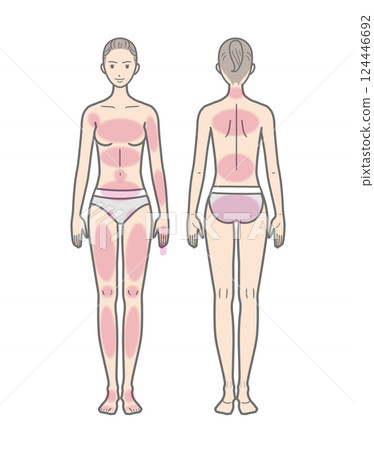 女性_A型_全身_粗線_包括治療區域 124446692