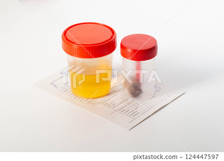 Urine and feces analysis on a medical direction on the table. Concept of tests in urology and gastroenterology, close-up Urine and feces analysis on a medical direction on the table. Concept of tests in urology and gastroenterology, close-up 124447597