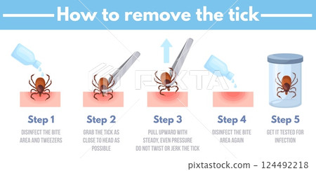 Tick removal. How to remove ticks insect infographics banner, mite bug animal human acarid bite prevention safety protection, tweezers parasite extraction neat vector illustration 124492218
