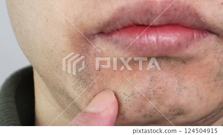 A Japanese man whose beard has thinned due to hair removal 124504915