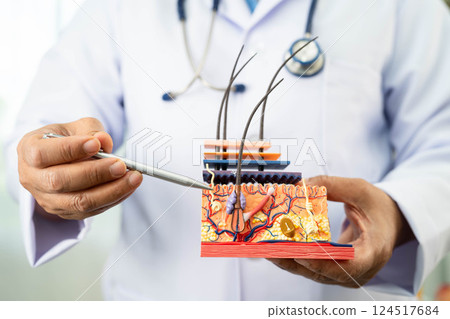 Hair transplant, Asian dermatologist doctor holding skin structure anatomy model for treatment in hospital. 124517684