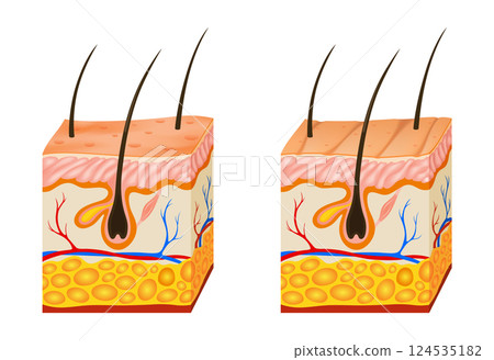 Oily and dry skin anatomy. Human body skin vector illustration with parts vein artery hair sweat gland epidermis dermis and hypodermis. Human Cross-section of the skin layers structure Oily and dry skin anatomy. Human body skin vector illustration with parts vein artery hair sweat gland epidermis dermis and hypodermis. Human Cross-section of the skin layers structure 124535182