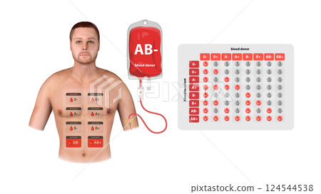 A 3D infographic showcasing AB Negative blood donation, universal recipient status, and compatibility in transfusion medicine, 3d 124544538