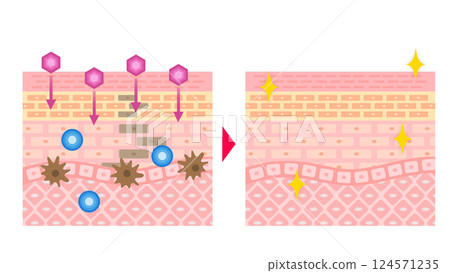 Image of the effect of whitening care | Cross-section showing melanin suppression and skin transparency 124571235