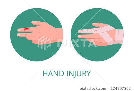 Injured human hand. Bandaged damaged arm, emergency treatment for skin cut flat vector illustration. Physical injury bandage 124597502